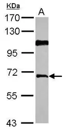 Anti-RIP / Rab antibody used in Western Blot (WB). GTX114963