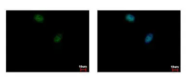 Anti-ELK3 antibody [N1C2] used in Immunocytochemistry/ Immunofluorescence (ICC/IF). GTX114966