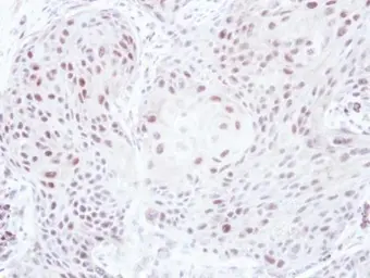 Anti-ELK3 antibody [N1C2] used in IHC (Paraffin sections) (IHC-P). GTX114966