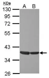 Anti-ELK3 antibody [N1C2] used in Western Blot (WB). GTX114966