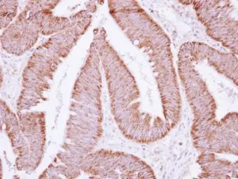 Anti-ATP synthase B1 antibody [N1C3] used in IHC (Paraffin sections) (IHC-P). GTX114970