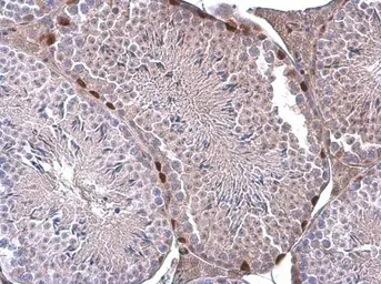 Anti-ERF antibody used in IHC (Paraffin sections) (IHC-P). GTX114971