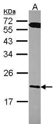 Anti-RGS10 antibody used in Western Blot (WB). GTX114973