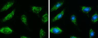 Anti-HSD17B4 antibody used in Immunocytochemistry/ Immunofluorescence (ICC/IF). GTX114978