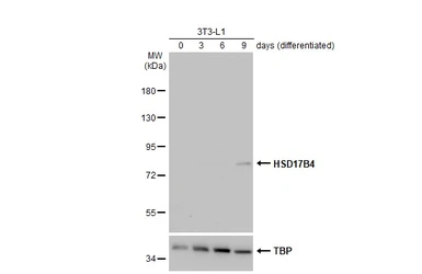 Anti-HSD17B4 antibody used in Western Blot (WB). GTX114978