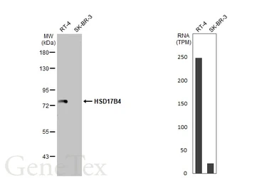 Anti-HSD17B4 antibody used in Western Blot (WB). GTX114978