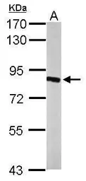 Anti-HSD17B4 antibody used in Western Blot (WB). GTX114978