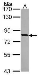 Anti-HSD17B4 antibody used in Western Blot (WB). GTX114978