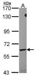 Anti-LTA4H antibody [N3C3] used in Western Blot (WB). GTX114986