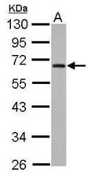 Anti-ZNF215 antibody used in Western Blot (WB). GTX114990