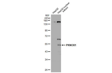 Anti-PKNOX1 antibody used in Western Blot (WB). GTX114991