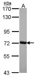 Anti-CSTF2 antibody [N1N2], N-term used in Western Blot (WB). GTX114994