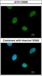 Anti-CNOT3 antibody [C2C3], C-term used in Immunocytochemistry/ Immunofluorescence (ICC/IF). GTX115005