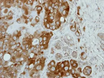 Anti-CNOT3 antibody [C2C3], C-term used in IHC (Paraffin sections) (IHC-P). GTX115005
