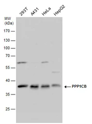 Anti-PPP1CB antibody used in Western Blot (WB). GTX115027