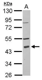 Anti-PDCD2 antibody [N2C3] used in Western Blot (WB). GTX115028