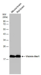 Anti-Visinin-like 1 antibody used in Western Blot (WB). GTX115039