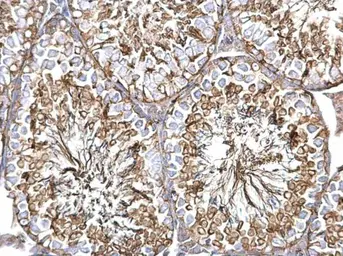 Anti-alpha Tubulin 1A antibody used in IHC (Paraffin sections) (IHC-P). GTX115048