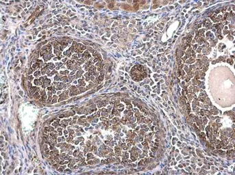 Anti-alpha Tubulin 1A antibody used in IHC (Paraffin sections) (IHC-P). GTX115048