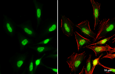 Anti-BRD3 antibody used in Immunocytochemistry/ Immunofluorescence (ICC/IF). GTX115058