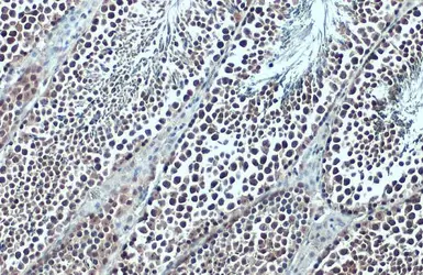 Anti-BRD3 antibody used in IHC (Paraffin sections) (IHC-P). GTX115058