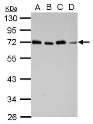 Anti-STAM antibody [N2C2], Internal used in Western Blot (WB). GTX115060