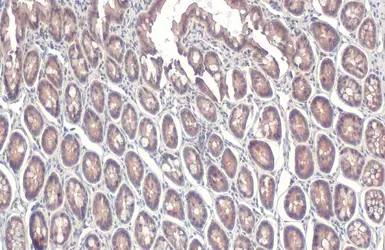 Anti-STAM antibody [N2C2], Internal used in IHC (Paraffin sections) (IHC-P). GTX115060