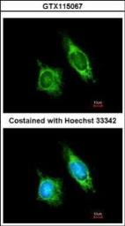 Anti-AKAP1 antibody [N1N2], N-term used in Immunocytochemistry/ Immunofluorescence (ICC/IF). GTX115067