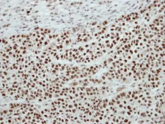 Anti-SAP62 antibody [N1C1] used in IHC (Paraffin sections) (IHC-P). GTX115068