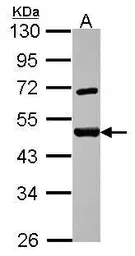 Anti-SAP62 antibody [N1C1] used in Western Blot (WB). GTX115068