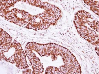 Anti-CLPP antibody [N2C3] used in IHC (Paraffin sections) (IHC-P). GTX115070