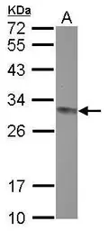 Anti-CLPP antibody [N2C3] used in Western Blot (WB). GTX115070