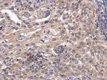 Anti-ACOX3 antibody used in IHC (Paraffin sections) (IHC-P). GTX115077