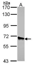 Anti-ACOX3 antibody used in Western Blot (WB). GTX115077
