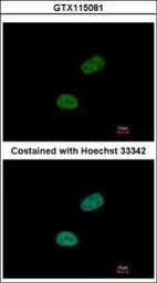 Anti-SRPX antibody [N3C3] used in Immunocytochemistry/ Immunofluorescence (ICC/IF). GTX115081