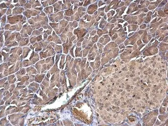 Anti-Transgelin 2 antibody [N1C3] used in IHC (Paraffin sections) (IHC-P). GTX115082