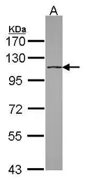 Anti-DHX16 antibody [C1C3] used in Western Blot (WB). GTX115088