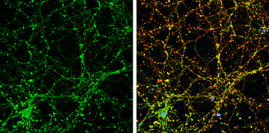 Anti-Liprin alpha 1 antibody [N1N2], N-term used in Immunocytochemistry/ Immunofluorescence (ICC/IF). GTX115098