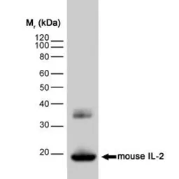 Anti-IL2 antibody [JES6-1A12] used in Western Blot (WB). GTX11510