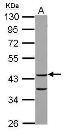 Anti-COPS3 antibody used in Western Blot (WB). GTX115102