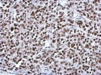 Anti-CGGBP1 antibody [N1C3] used in IHC (Paraffin sections) (IHC-P). GTX115103