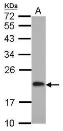Anti-CGGBP1 antibody [N1C3] used in Western Blot (WB). GTX115103