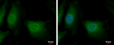 Anti-DENR antibody used in Immunocytochemistry/ Immunofluorescence (ICC/IF). GTX115106