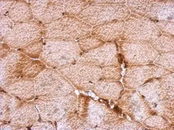 Anti-DENR antibody used in IHC (Paraffin sections) (IHC-P). GTX115106