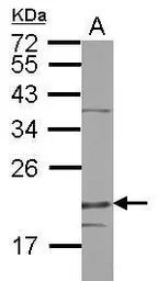 Anti-DENR antibody used in Western Blot (WB). GTX115106