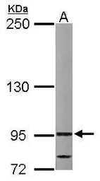 Anti-VDP / p115 antibody [N1N2], N-term used in Western Blot (WB). GTX115114