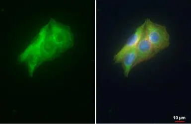 Anti-VDP / p115 antibody [N1N2], N-term used in Immunocytochemistry/ Immunofluorescence (ICC/IF). GTX115114