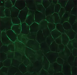 Anti-E-Cadherin antibody [DECMA-1] used in Immunocytochemistry/ Immunofluorescence (ICC/IF). GTX11512