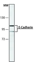 Anti-E-Cadherin antibody [DECMA-1] used in Western Blot (WB). GTX11512