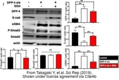 Anti-E-Cadherin antibody [DECMA-1] used in Western Blot (WB). GTX11512